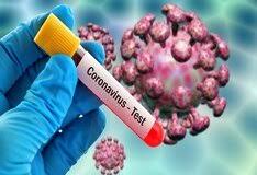 Novacyt launches novel coronavirus test 1